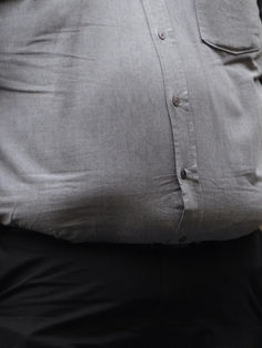 Especialistas piden redefinir la obesidad como enfermedad y mejorar abordaje
