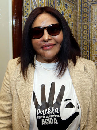 Sentencian por primera vez en México a un hombre que atacó con ácido a una mujer 