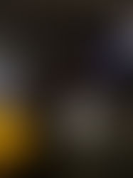 Nueva terapia da esperanza a pacientes con fibrosis pulmonar en México