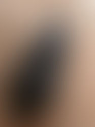 Exhortan a chiapanecos a mantener espacios limpios para evitar el Chagas 