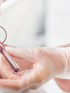 Hospital Gómez Maza logró reducir infecciones asociadas con catéteres