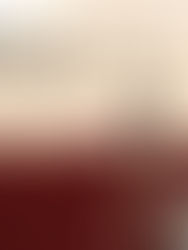 Mil 483 casos acumulados y 113 defunciones por COVID-19 en Chiapas