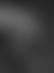 En México al Menos 20 Mil Personas Viven con Esclerosis Múltiple