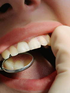 De no ser atendidas, las caries pueden conducir a la muerte