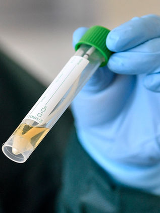 Repartirán 10 mil kits con Ivermectina para combatir Covid-19 en Tuxtla