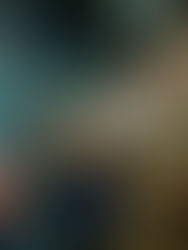 Los pacientes con hemofilia adquirida mueren a menudo sin un diagnóstico