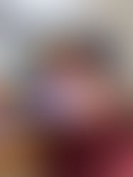 África registra mayor mortalidad de enfermos de covid críticos