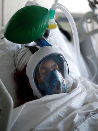 Éste es el gen que predispone a las personas a sufrir un Covid-19 grave