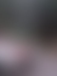 Chiapas sin registro de defunciones por dengue, gracias a las acciones de prevención y control 