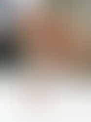 Un análisis de sangre detecta tumores cuatro años antes que los métodos convencionales