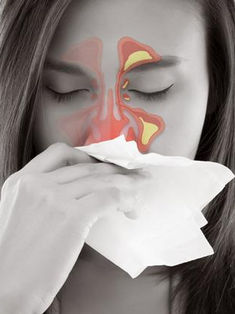 Aumentan hasta en 30 por ciento casos de sinusitis y rinitis