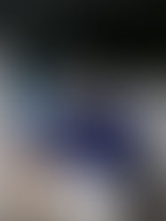 Covid sigue latente en América, que ve la situación en Europa como profética