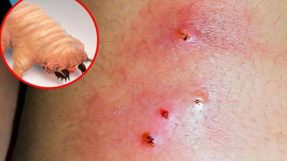 Chiapas concentra cuatro nuevos casos de gusano barrenador en humanos 