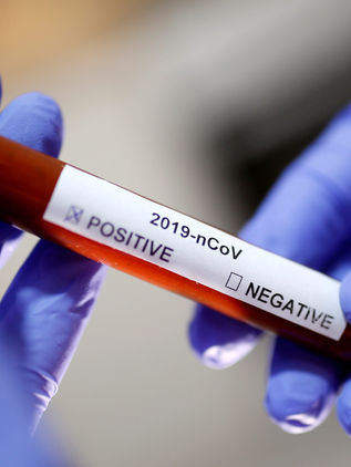 Prueba Rusia en animales una vacuna contra coronavirus