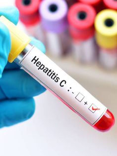 Hepatitis C, el tipo más complicado