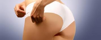 Gluteoplastia | Aumento de glúteos
