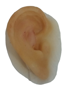 ear prosthesis in Colombia