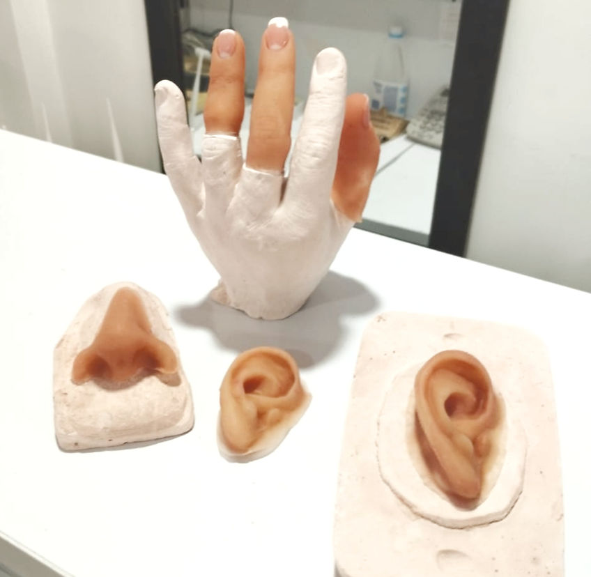 Protesis de alta calidad_edited.jpg