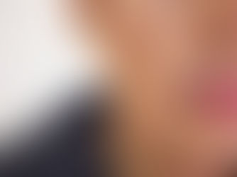 Cosmetology Treatments for Hyperpigmentation: What Really Works?