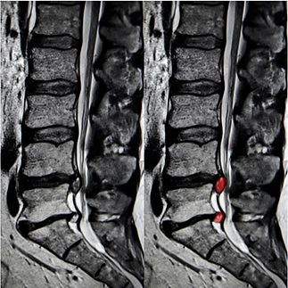 mri.jpg