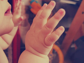 עיכוב התפתחותי