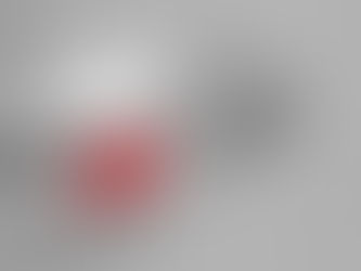 バネ指の改善例