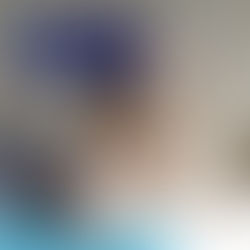 Como a hidratação ajuda a cuidar da sua coluna no calor