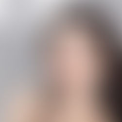 抗衰老新方式 - \ 只要專注 / 嘴周下垂