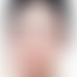 【童顏針邊間好】Sculptra 原理、打幾多次先有效？醫生解構副作用與按摩技巧
