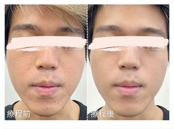 20251023_毛孔管理學 output-15.png
