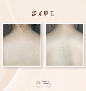 脫毛 (1).jpg