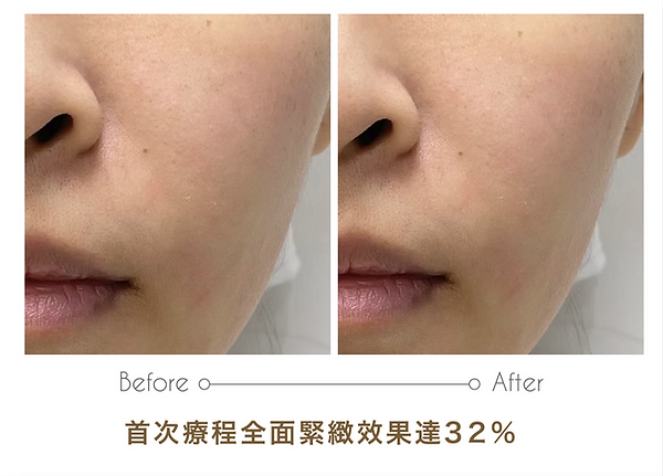 20251015_6D Filler output-09.png