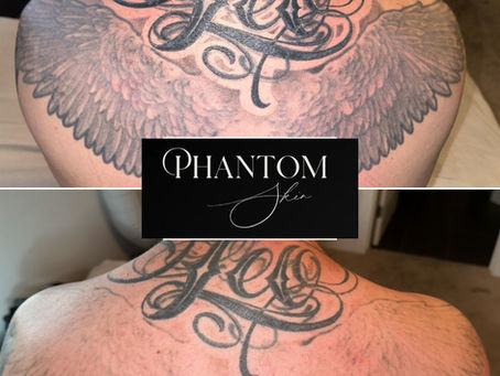 Why Fading Your Ink at Phantom Skin is the Secret to a Better Cover-Up