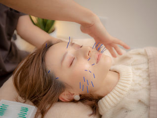 顔の冷えによる肌トラブルを美容鍼で解決