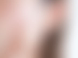 くすみと美容鍼灸