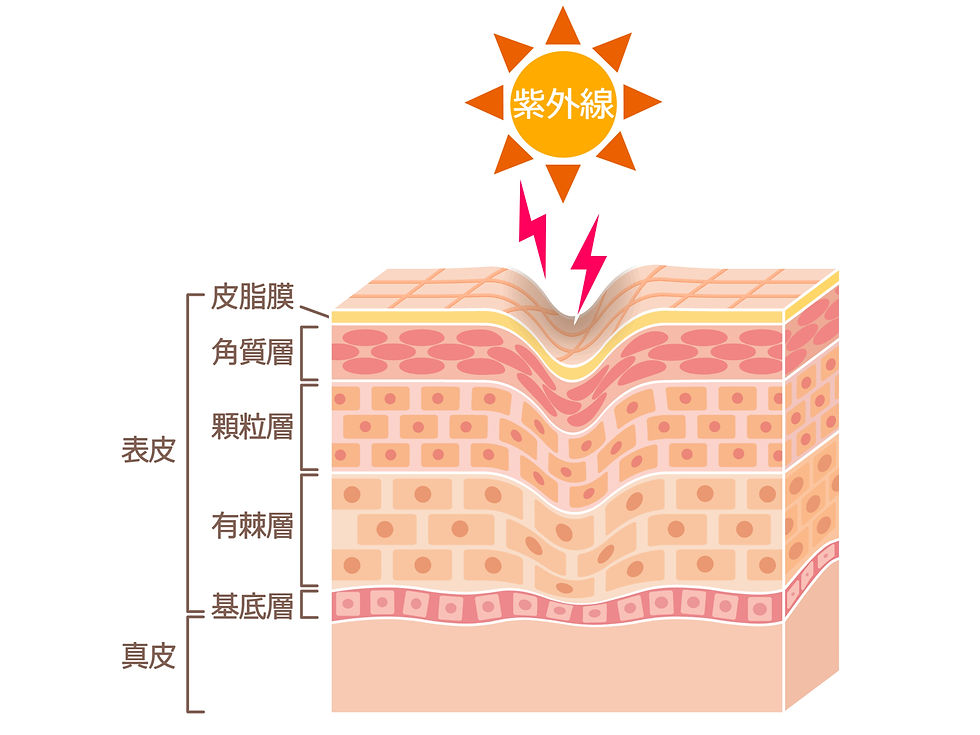 紫外線による肌ダメージ