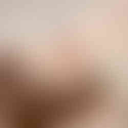 美容鍼を受けている女性