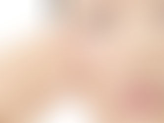 肌荒れと美容鍼灸