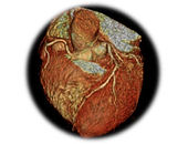 【心臓画像クリニック飯田橋-CVIC-】心臓MRI検査・心臓ドッ