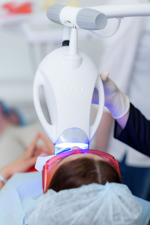Teeth whitening.jpeg