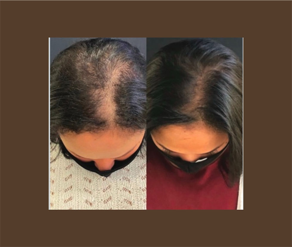 Split image showing a woman's hair before and after treatment. Left: thinning hair. Right: fuller hair. Neutral background. Brown and burgundy attire.