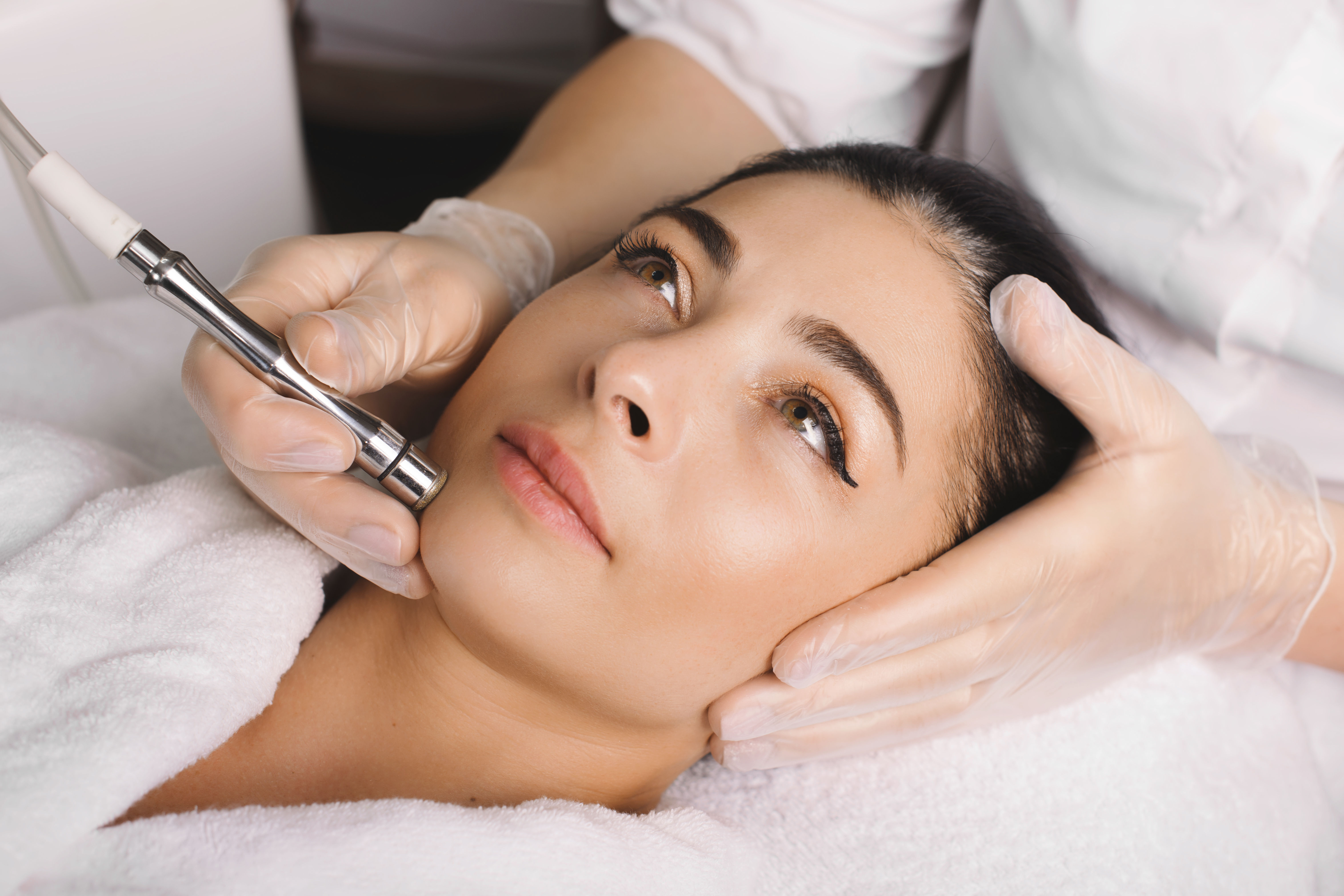 Microdermabrasion