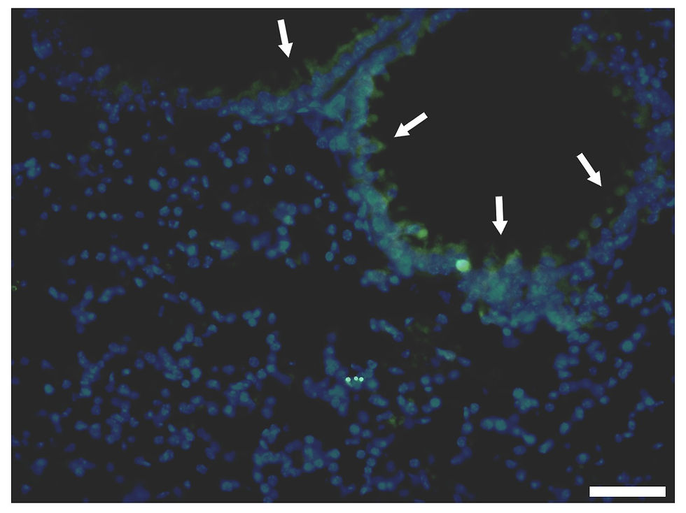 Diniz et al 2012 MIOC Fig 7 - Lung Enriched Aged - 40x.jpg