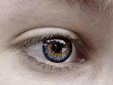 What Are Eye Floaters and When Should You Worry?