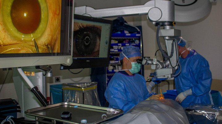 Fredericksburg TX Cataract surgery