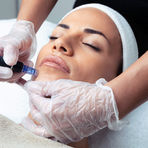 Chemical Peel - Hydra
