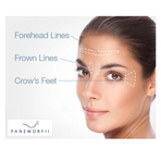 Anti Wrinkle Treatment Sites