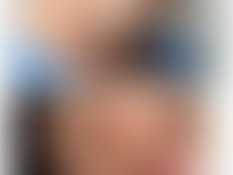 Mini Facelift vs Facelift Completo: Consejo Experto de la Dra. Amy Barreto en Bogotá – Zona Norte