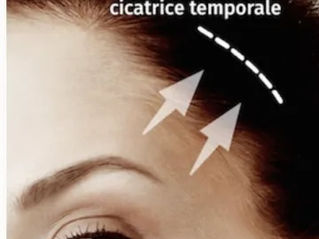 La perio-orbitoplastia en Medellin