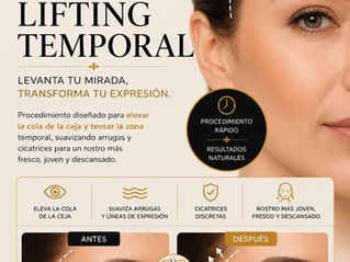 Lifting Temporal y Técnicas de Rejuvenecimiento Periocular en El Poblado Medellín: Rejuvenecimiento Natural de la Mirada